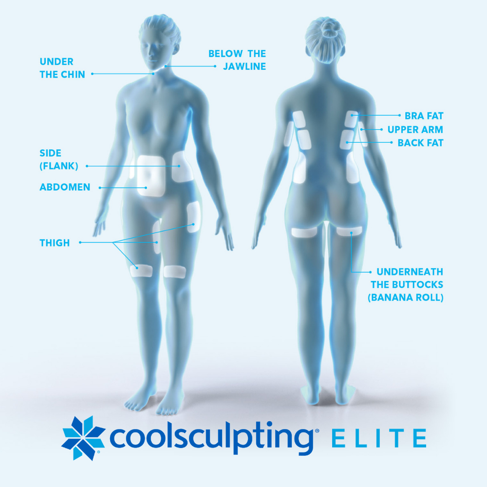 COOLSCULPTING TARGETS ANNOYING TROUBLE SPOTS