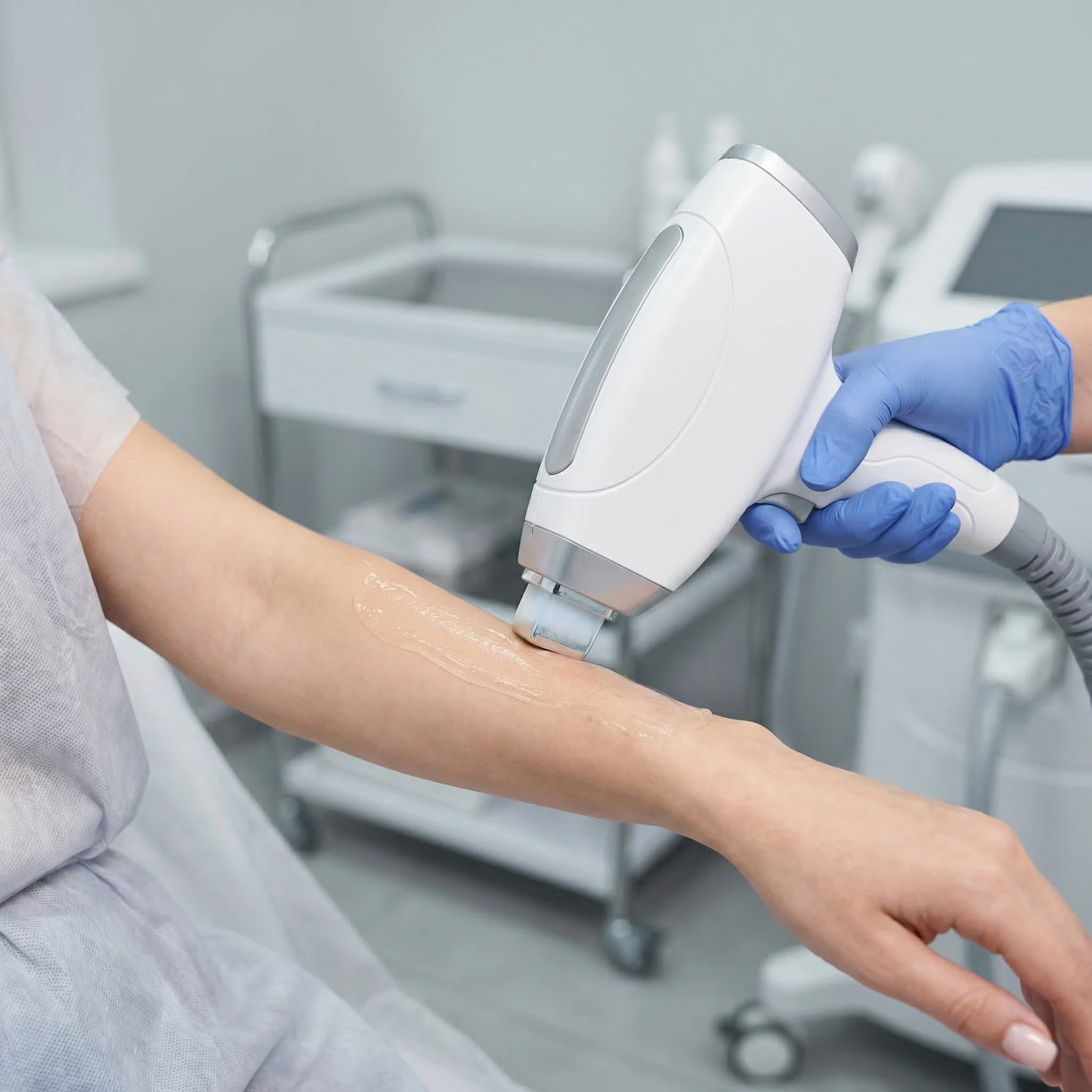 Close-up of laser hair removal device gliding across patient's skin during professional treatment