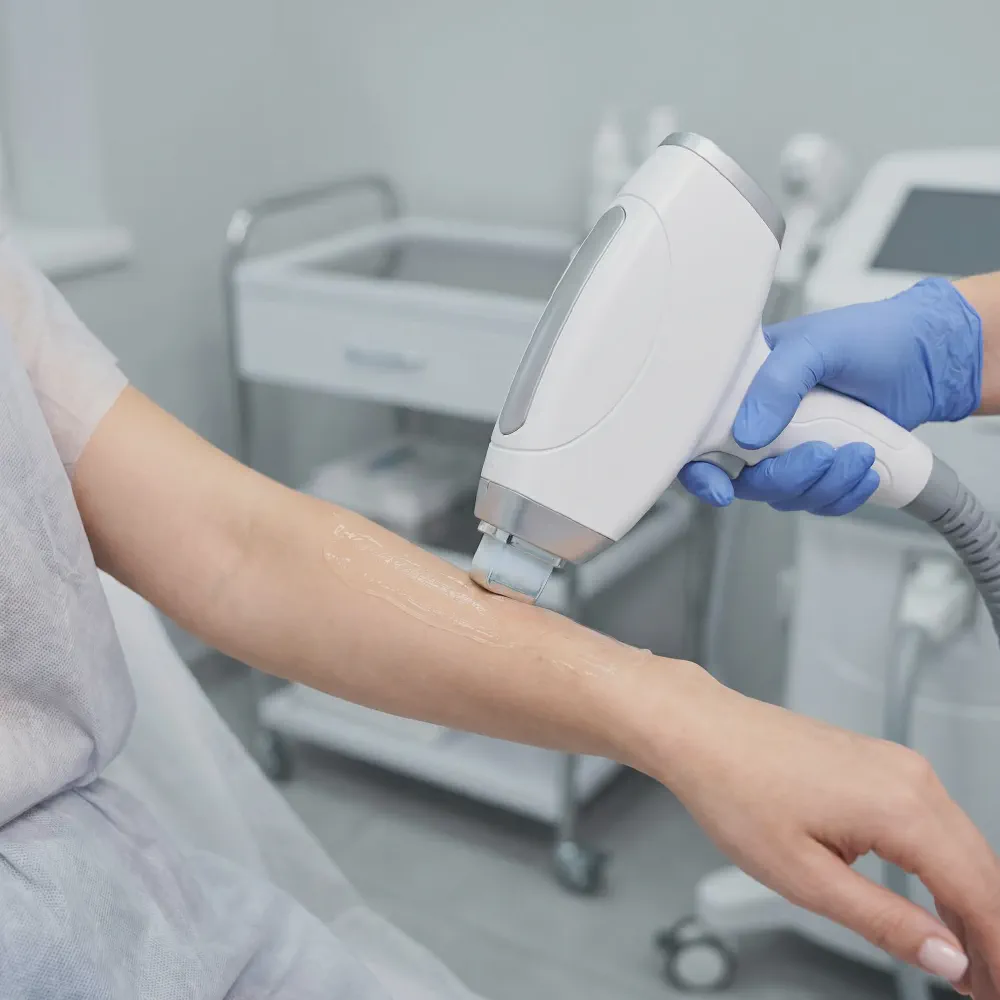 Close-up of a laser hair removal handpiece gliding across a client's skin during treatment