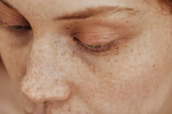 Close-up of female face with freckles